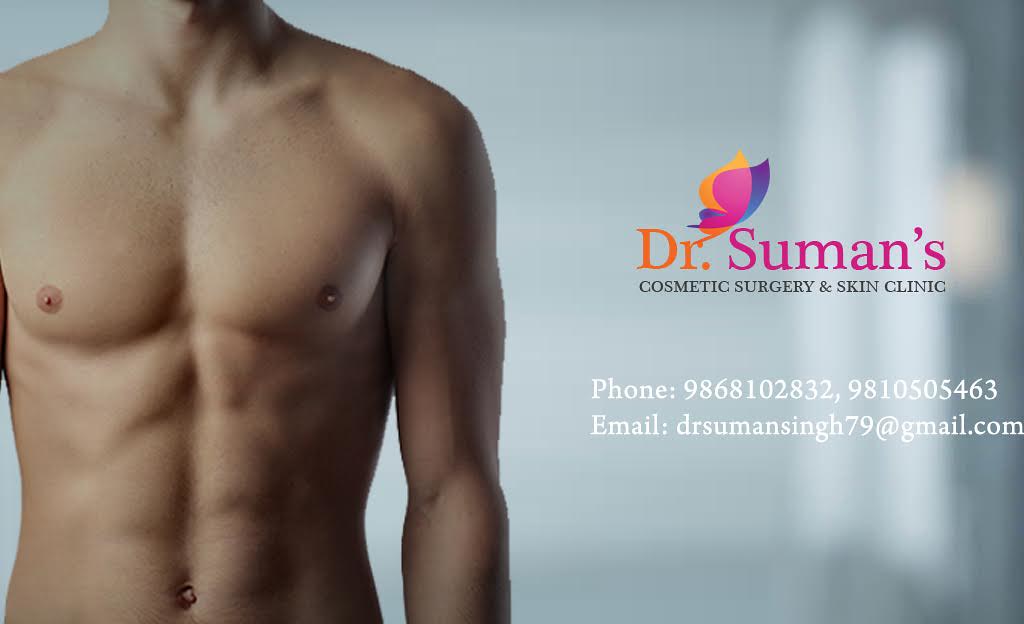 gynaecomastia